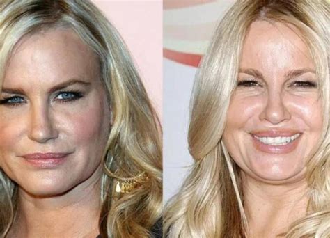 jennifer coolidge before surgery|Jennifer Coolidge: A Look Before Plastic Surgery